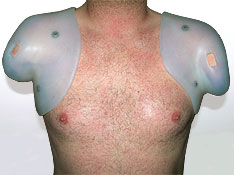 RTV-Silikon f&uuml;r Oberarmschaft